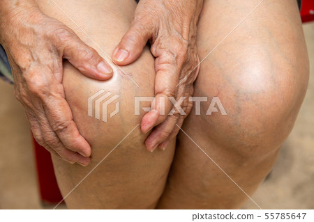 Senior woman suffering from knees pain Senior woman suffering from knees pain 55785647