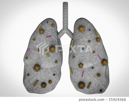 lung disease with bacteria cells lung disease with bacteria cells 55929368