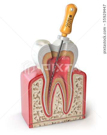 Cross section of Human tooth with endodontic file Cross section of Human tooth with endodontic file 55929447
