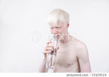 portrait of an albino man in studio dressed 55929524