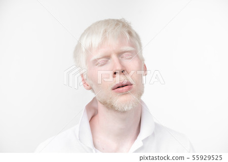 portrait of an albino man in studio dressed 55929525