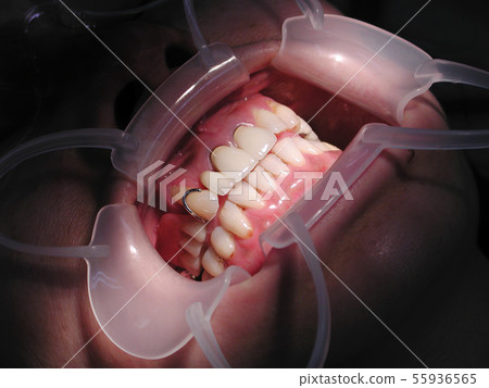 Dental treatment Dental treatment 55936565