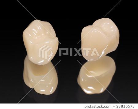 White teeth and insurance CAD / CAM crowns that can be cured with insurance 55936573