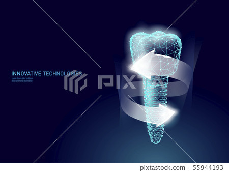 Molar tooth dental implant 3d low poly geometric model. Dentistry innovation future technology titan 55944193