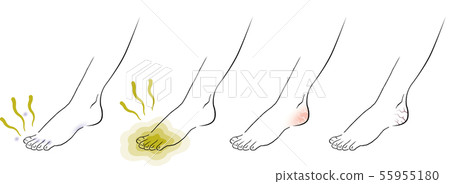 Foot trouble Foot care 55955180