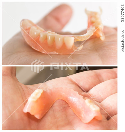 flexible nylon denture 55977408