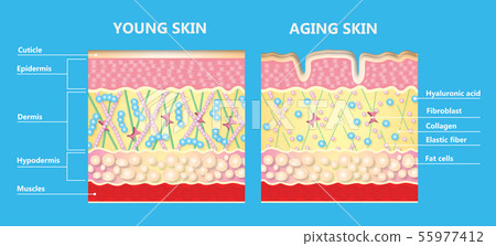 The diagram of younger skin and aging skin - Stock Illustration ...