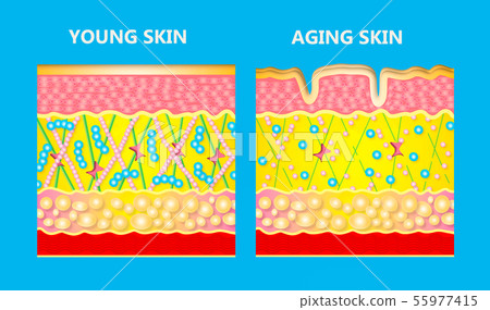 The diagram of younger skin and aging skin - Stock Illustration ...