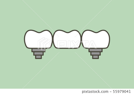 dental bridge, teeth change new root 55979041