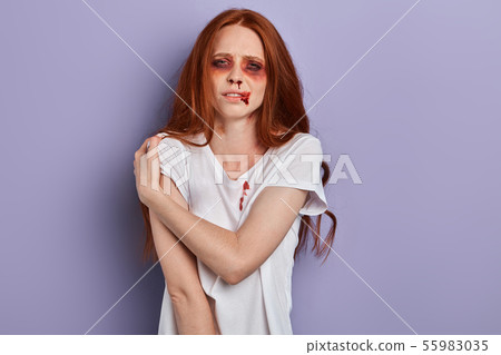 ginger poor woman has a shoulder hurt bruise ginger poor woman has a shoulder hurt bruise 55983035