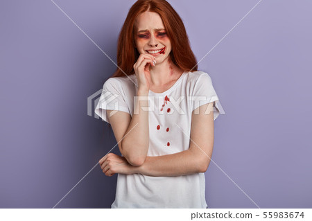 red-haired girl touching her lips, she has ugly bruises on face red-haired girl touching her lips, she has ugly bruises on face 55983674
