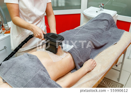 Cryolipolysis fat freezing treatment. Weight loss 55990612