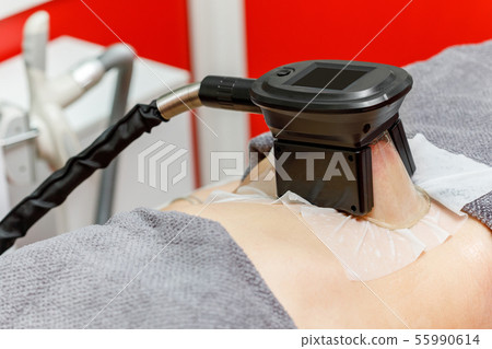Cryolipolysis fat freezing treatment. Weight loss Cryolipolysis fat freezing treatment. Weight loss 55990614