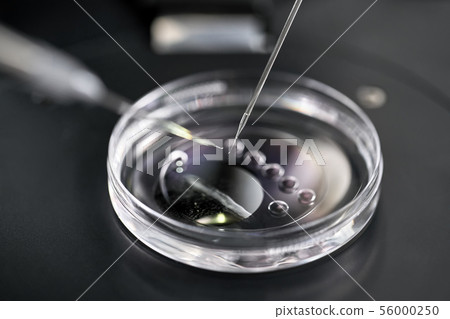 Process of in vitro fertilization in laboratory 56000250