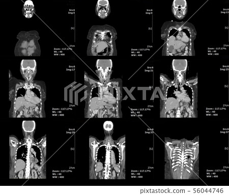 medical radiology medical radiology 56044746