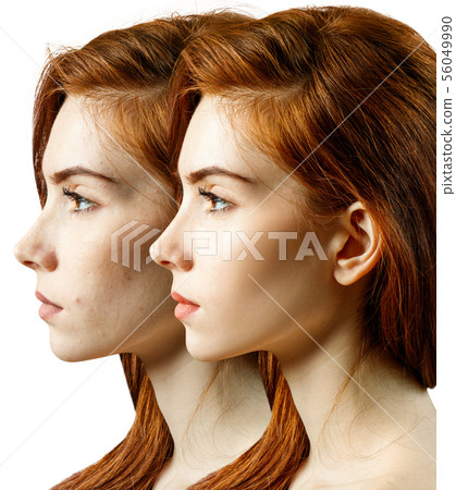 Comparison portrait of young woman before and after retouch. 56049990