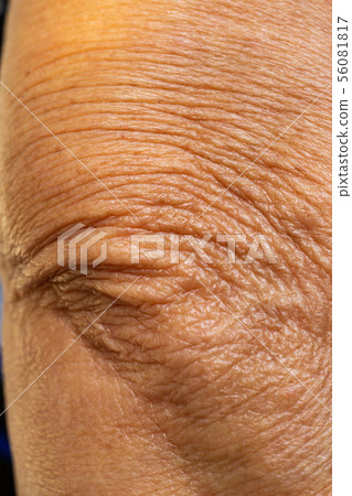 Asian senior woman's wrinkled elbow, Close up 56081817