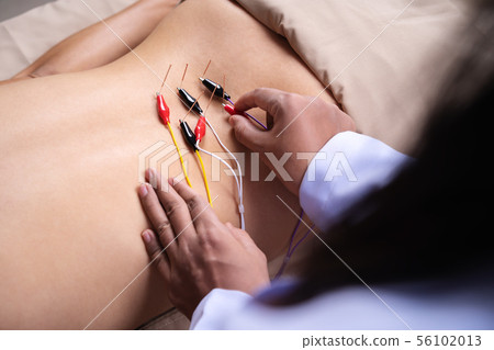 woman undergoing acupuncture treatment with woman undergoing acupuncture treatment with 56102013