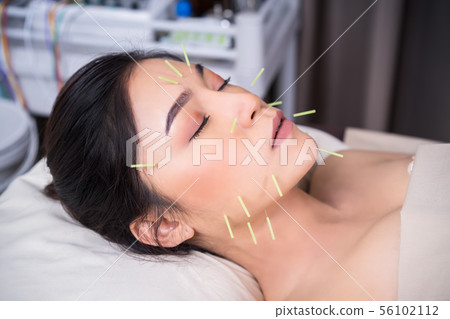 woman undergoing acupuncture treatment on face woman undergoing acupuncture treatment on face 56102112