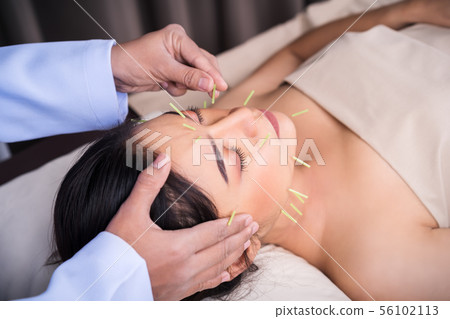 woman undergoing acupuncture treatment on face woman undergoing acupuncture treatment on face 56102113