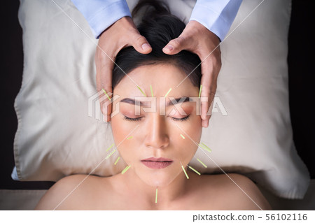 woman undergoing acupuncture treatment on face woman undergoing acupuncture treatment on face 56102116