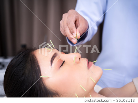 woman undergoing acupuncture treatment on face 56102118