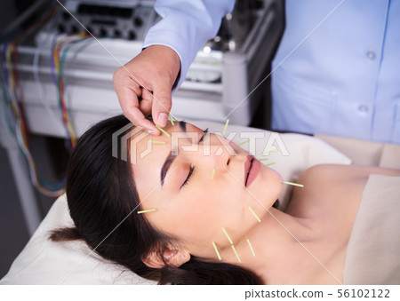woman undergoing acupuncture treatment on face woman undergoing acupuncture treatment on face 56102122