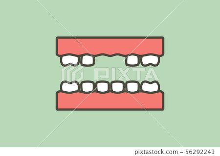 missing tooth, space between teeth 56292241