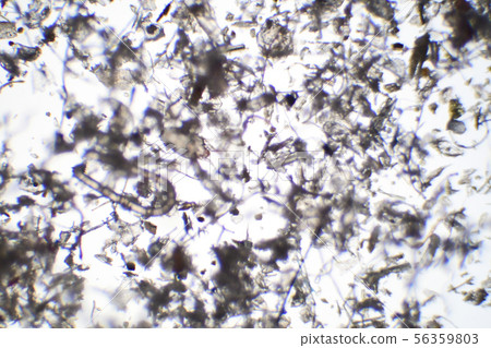 House dust and mite House dust and mite 56359803