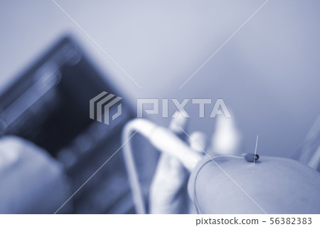 EPI dry needling ultrasound scan EPI dry needling ultrasound scan 56382383