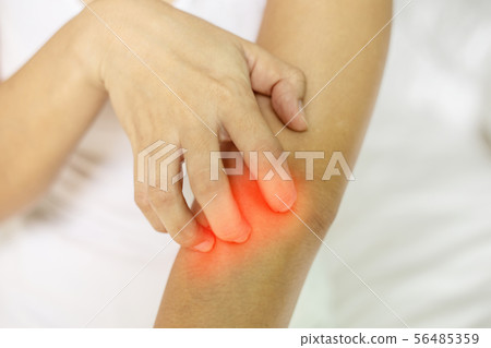 Woman itch hand arm and scratch and have problem Woman itch hand arm and scratch and have problem 56485359