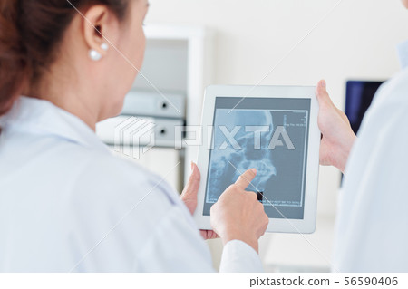 Doctors discussing scull x-ray 56590406