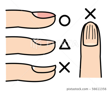 Health check with nails 56611356