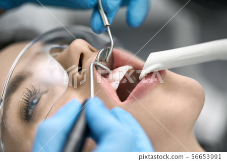 Pretty woman's teeth cleaning in dental clinic 56653991