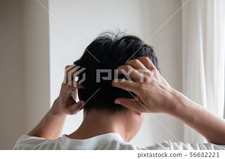 Scalp, dandruff, itch, hair loss, thinning hair 56682221