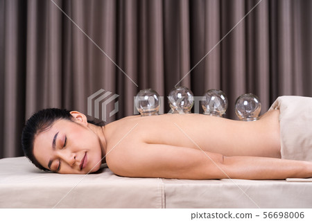 woman receiving cupping treatment on back 56698006