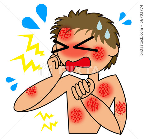 Illustration of dermatitis - Stock Illustration [56703774] - PIXTA