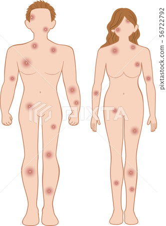 Purulent whole body before men and women set 56722792