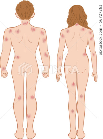 Scratch wound, whole body behind men and women set Scratch wound, whole body behind men and women set 56727263