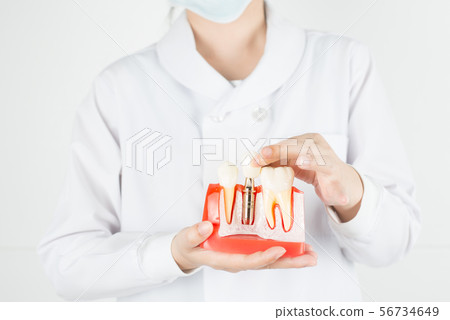 Dentist show model of dental implant. 56734649