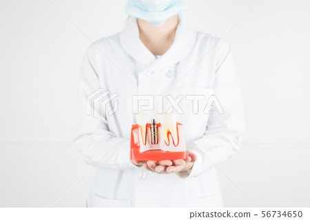 Dentist show model of dental implant. Dentist show model of dental implant. 56734650