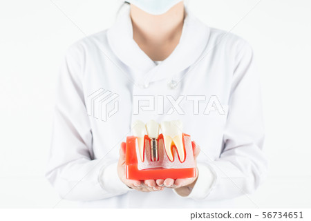 Dentist show model of dental implant. Dentist show model of dental implant. 56734651