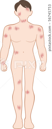 Scratch wound full body front male 56745753