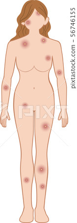 在女性面前潰爛全身 56746155