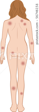 女人身後的化膿身體 56746158