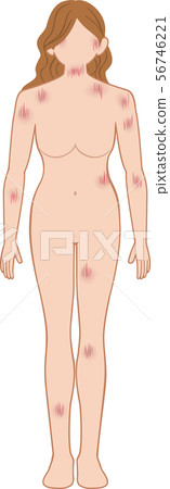 Scratches in front of the whole woman Scratches in front of the whole woman 56746221