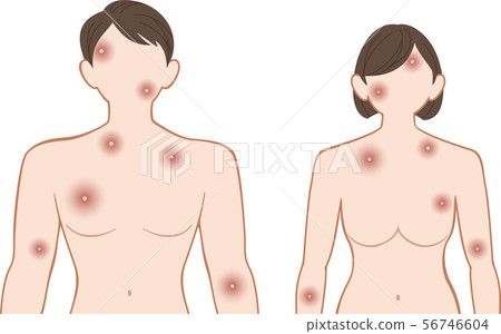 潰爛的上身，前面的男人和女人集 56746604