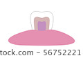 White tooth inside illustration-transparent png 56752221