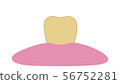 Yellowed and dirty teeth 56752281