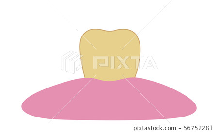 Yellowed and dirty teeth Yellowed and dirty teeth 56752281